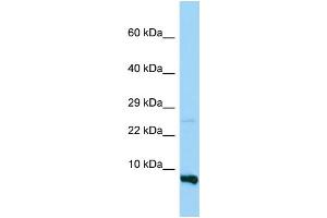WB Suggested Anti-RPS28 Antibody Titration: 1. (RPS28 anticorps  (N-Term))