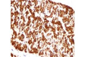 DES / Desmin antibody immunohistochemistry analysis in formalin fixed and paraffin embedded human heart tissue.
