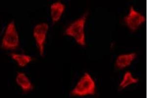 ABIN6278606 staining MCF7 by IF/ICC. (OR2T3/2T34 anticorps)