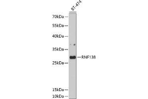 Western blot analysis of extracts of BT-474 cells, using RNF138 antibody (ABIN6128751, ABIN6147014, ABIN6147015 and ABIN6214506) at 1:1000 dilution. (RNF138 anticorps)