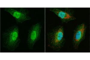 ICC/IF Image WBSCR22 antibody detects WBSCR22 protein at cytoplasm and nucleus by immunofluorescent analysis.