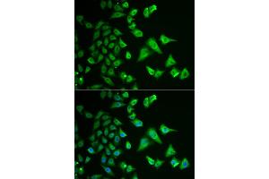 Immunofluorescence analysis of HeLa cells using DHRS2 antibody (ABIN5973846). (DHRS2 anticorps)