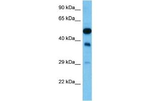 Host:  Mouse  Target Name:  FEN1  Sample Tissue:  Mouse Testis  Antibody Dilution:  1ug/ml (FEN1 anticorps  (N-Term))