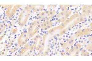 Detection of TPSb2 in Mouse Kidney Tissue using Polyclonal Antibody to Tryptase Beta 2 (TPSb2)
