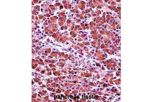 Immunohistochemistry (IHC) image for anti-Elastase 3B, Pancreatic (ELA3B) antibody (ABIN2997529)