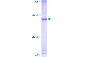 Image no. 1 for Zinc Finger Protein 93 (ZNF93) (AA 1-123) protein (GST tag) (ABIN1326475)