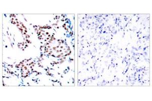 Immunohistochemistry (IHC) image for anti-Jun Proto-Oncogene (JUN) (Tyr170) antibody (ABIN1848122) (C-JUN anticorps  (Tyr170))