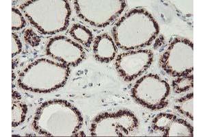 Image no. 8 for anti-Golgi Membrane Protein 1 (GOLM1) antibody (ABIN1498491)