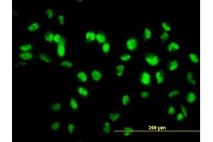 Immunofluorescence of monoclonal antibody to SIRT1 on HeLa cell. (SIRT1 anticorps  (AA 456-555))