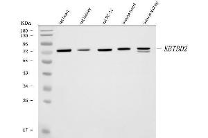 Western blot analysis of KBTBD2 using anti-KBTBD2 antibody (ABIN6719647). (KBTBD2 anticorps)