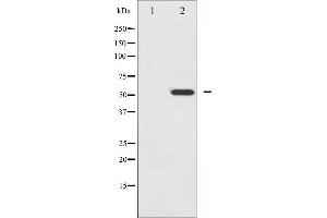 Western blot analysis of HNF4 alpha phosphorylation expression in EGF treated HuvEc whole cell lysates,The lane on the left is treated with the antigen-specific peptide. (HNF4A anticorps  (pSer313))