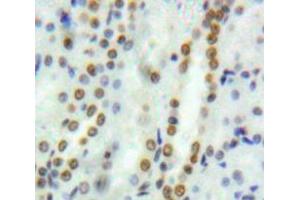 Used in DAB staining on fromalin fixed paraffin-embedded Kidney tissue (GATA2 anticorps  (AA 117-338))