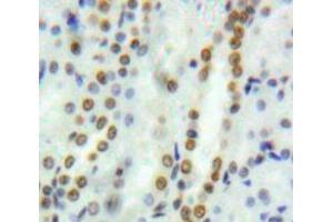 Used in DAB staining on fromalin fixed paraffin-embedded Kidney tissue