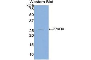 Western blot analysis of the recombinant protein. (CAMKII gamma anticorps  (AA 75-281))