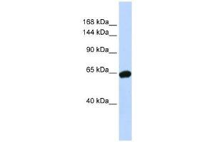 Western Blot showing ZNF91 antibody used at a concentration of 1-2 ug/ml to detect its target protein. (ZFP91 anticorps  (N-Term))