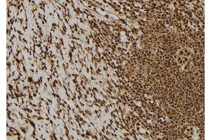 ABIN6276293 at 1/100 staining Human gastric tissue by IHC-P. (BCL2L1 anticorps  (N-Term))