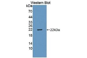 Detection of Recombinant IL5Ra, Mouse using Polyclonal Antibody to Interleukin 5 Receptor Alpha (IL5Ra)