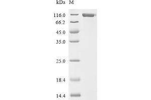 (Tris-Glycine gel) Discontinuous SDS-PAGE (reduced) with 5 % enrichment gel and 15 % separation gel.