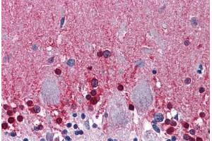 Human Brain, Cerebellum: Formalin-Fixed, Paraffin-Embedded (FFPE) (CBS anticorps  (AA 1-101))