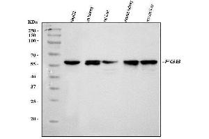 Western blot analysis of Fibrinogen beta chain/FGB using anti-Fibrinogen beta chain/FGB antibody (ABIN4886579). (Fibrinogen beta Chain anticorps  (Middle Region))