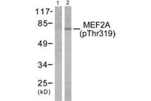 Western blot analysis of extracts from K562 cells treated with UV 15', using MEF2A (Phospho-Thr319) Antibody. (MEF2A anticorps  (pThr319))
