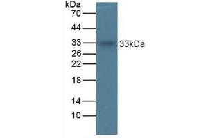 Figure. (TPSAB1 anticorps  (AA 161-262))