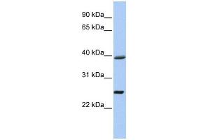 C12ORF42 antibody used at 1 ug/ml to detect target protein. (C12orf42 anticorps  (N-Term))