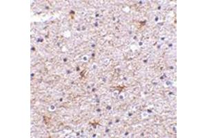Immunohistochemistry of TMP21 in human brain tissue with this product at 2.