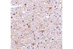 Immunohistochemistry of TMP21 in human brain tissue with this product at 2.