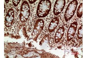 Immunohistochemistry (IHC) analysis of paraffin-embedded Human Colon, antibody was diluted at 1:100. (HLA-DQ1/DQ2 anticorps  (Internal Region))