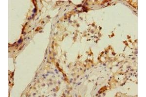 Immunohistochemistry of paraffin-embedded human testis tissue using ABIN7171407 at dilution of 1:100 (CD8B anticorps  (AA 22-170))