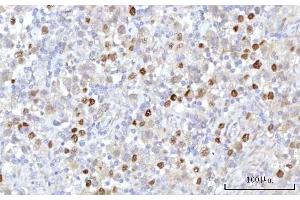 IHC analysis of RRP7A using anti-RRP7A antibody (ABIN7599044). (RRP7A anticorps  (AA 1-181))