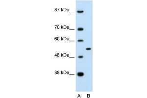 WB Suggested Anti-APBA1 Antibody Titration:  0. (APBA1 anticorps  (N-Term))