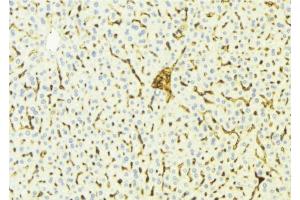 ABIN6275808 at 1/100 staining Mouse liver tissue by IHC-P. (CYP4V2 anticorps  (Internal Region))