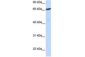 Image no. 1 for anti-L(3)mbt-Like 1 (L3MBTL1) (AA 144-193) antibody (ABIN6742622) (L3MBTL1 anticorps  (AA 144-193))