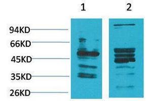 Western Blotting (WB) image for anti-Neuromedin B Receptor (NMBR) antibody (ABIN3179060) (NMBR anticorps)