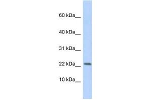 WB Suggested Anti-P2RX7 Antibody Titration: 0. (P2RX7 anticorps  (Middle Region))