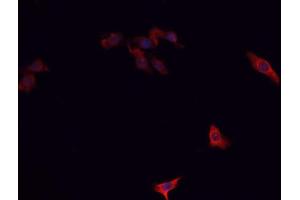 ABIN6266732 staining A-431 cells by IF/ICC. (PTTG1 anticorps  (Internal Region))