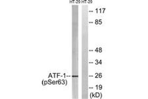 Western blot analysis of extracts from HT29 cells treated with Insulin 0. (AFT1 anticorps  (pSer63))