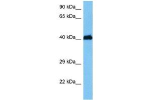 Host:  Mouse  Target Name:  HMBOX1  Sample Tissue:  Mouse Brain  Antibody Dilution:  1ug/ml