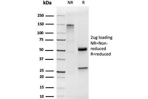 SDS-PAGE Analysis of Purified Cytokeratin 19 Rabbit Recombinant Monoclonal Antibody (KRT19/1959R).
