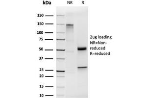 SDS-PAGE Analysis of Purified Cytokeratin 19 Rabbit Recombinant Monoclonal Antibody (KRT19/1959R). (Recombinant Cytokeratin 19 anticorps)