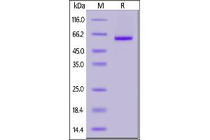 SARS-CoV-2 S protein RBD, Mouse IgG2a Fc Tag on SDS-PAGE under reducing (R) condition.