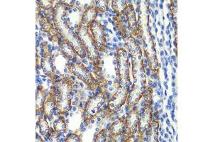 Immunohistochemistry of paraffin-embedded rat kidney using ZF antibody (ABIN6130814, ABIN6150426, ABIN6150427 and ABIN6223369) at dilution of 1:100 (40x lens).
