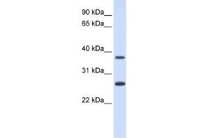 WB Suggested Anti-FAM156A Antibody Titration:  0. (FAM156A anticorps  (N-Term))