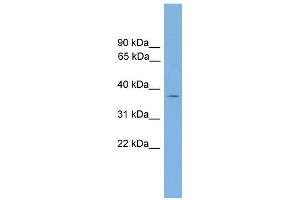 WB Suggested Anti-GALM Antibody Titration: 0. (GALM anticorps  (Middle Region))