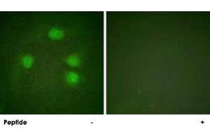 Immunofluorescence analysis of HeLa cells, using KCNJ3 polyclonal antibody . (KCNJ3 anticorps  (Ser185))