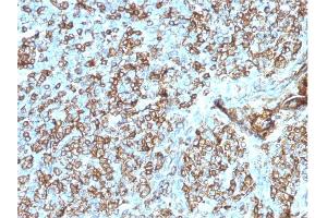 Formalin-fixed, paraffin-embedded human Tonsil stained with HLA- Pan Mouse Monoclonal Antibody (CR3/43). (MHC Class II HLA-DP/DQ/DR anticorps)