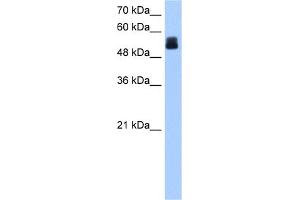WB Suggested Anti-CRISPLD2 Antibody Titration:  0. (CRISPLD2 anticorps  (N-Term))