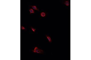 anti-Decorin (DCN) (Internal Region) antibody